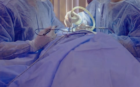 手术协议书锦集6篇