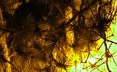 �������ֵķ���������Ԥ����ʩ